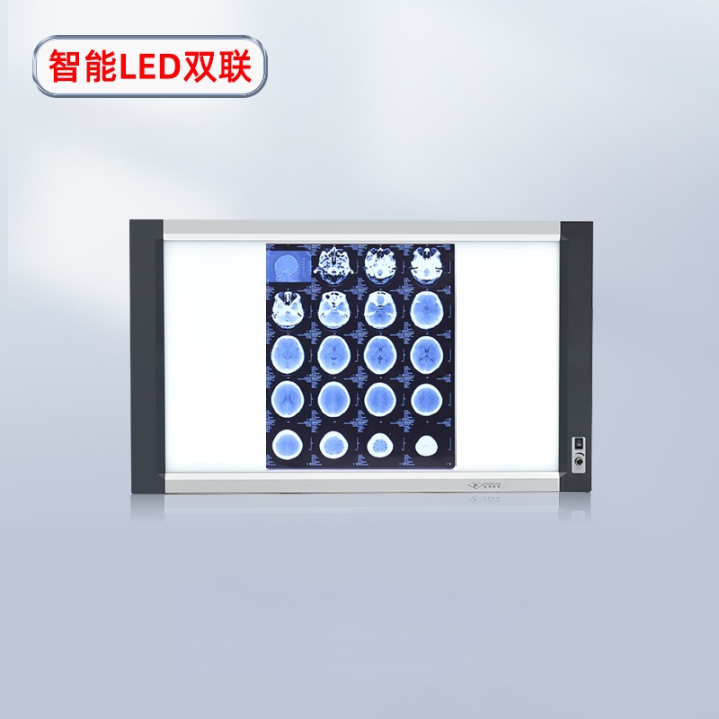 LED Induction X -ray Film Viewer
